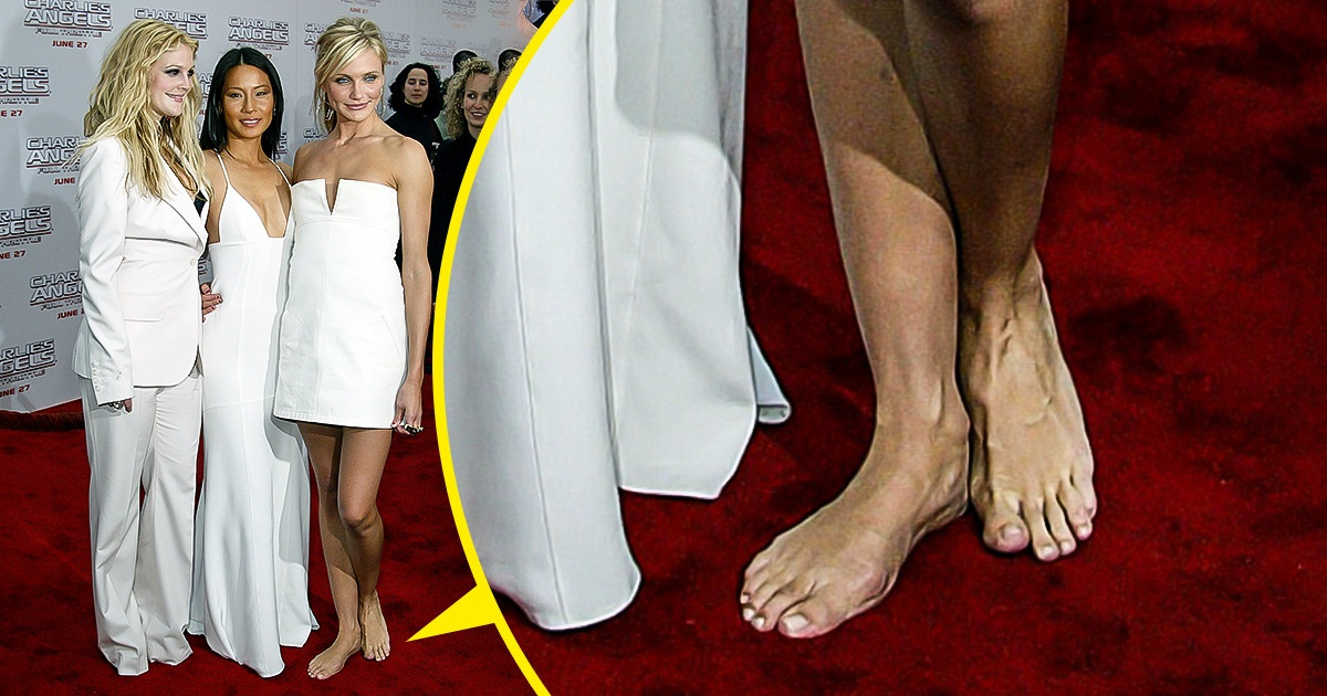 8 個名人們可能永遠無法抹滅的凸槌時刻 8 個名人們可能永遠無法抹滅的凸槌時刻